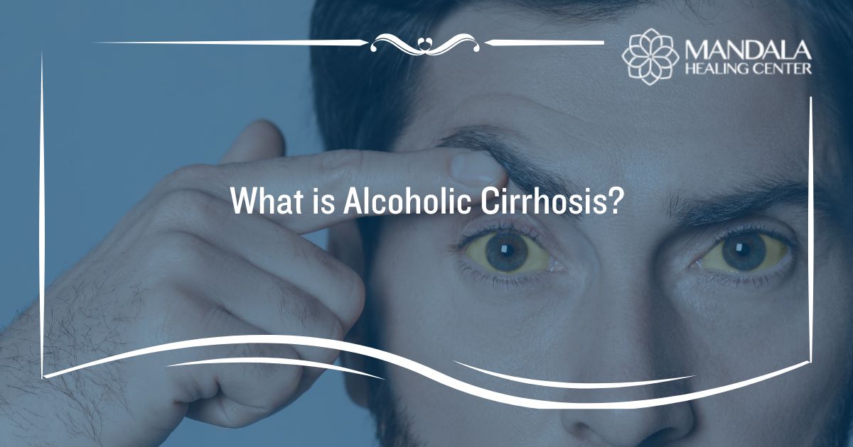 What is Alcoholic Cirrhosis